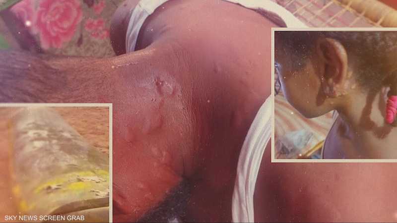 تحقيق يكشف عن استخدام أسلحة كيميائية في السودان